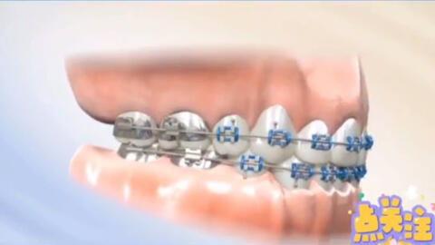 成人歪嘴型矫正视频,轻松掌握成人歪嘴矫正技巧