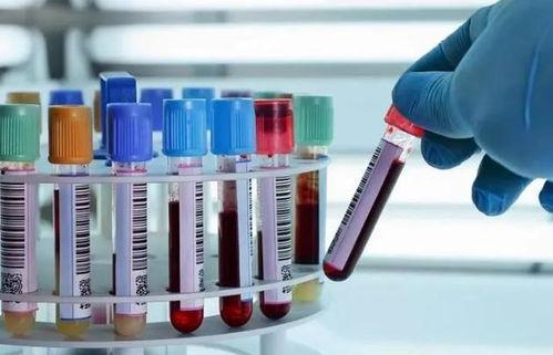 成人脚面抽血视频大全,专业视频大全解析