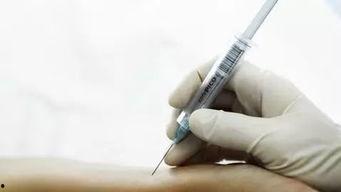 成人动脉采血视频讲解,动脉采血操作步骤与技巧解析